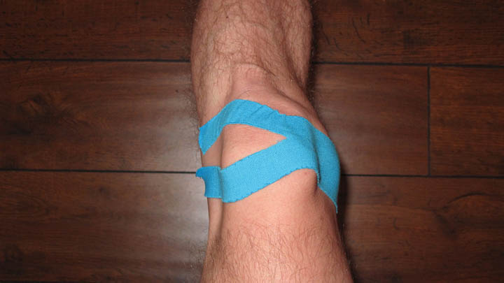 To knee or not to knee…that is the question!