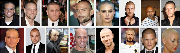 The real reason the men in your life are bald…