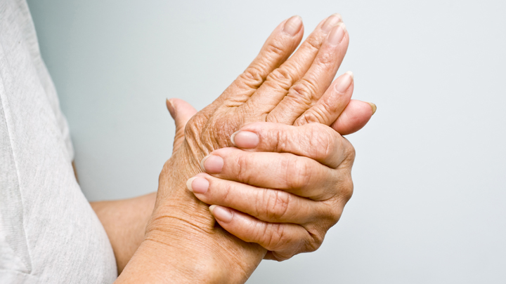 Calming arthritis naturally