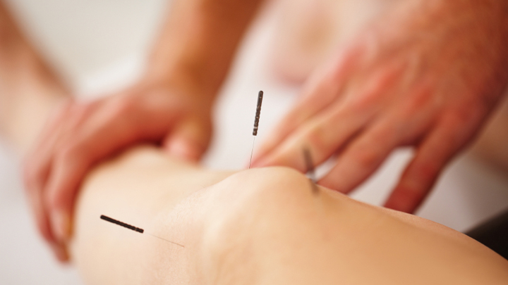 Reducing chronic pain with acupuncture: what all over 60 sufferers need to know