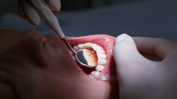 Eight reasons why a dental check up is vital for you