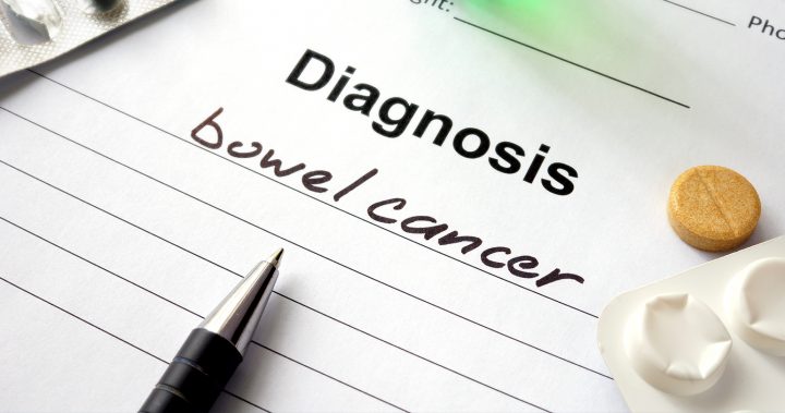 The easiest way to prevent bowel cancer