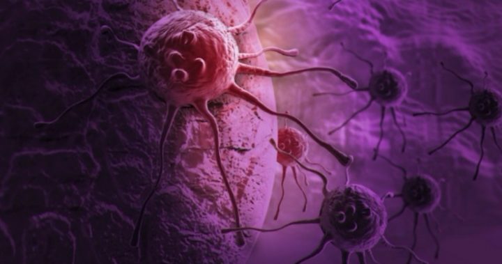 Cancer Riddled Organ Major breakthrough: Scientists discover new human organ - Starts at 60