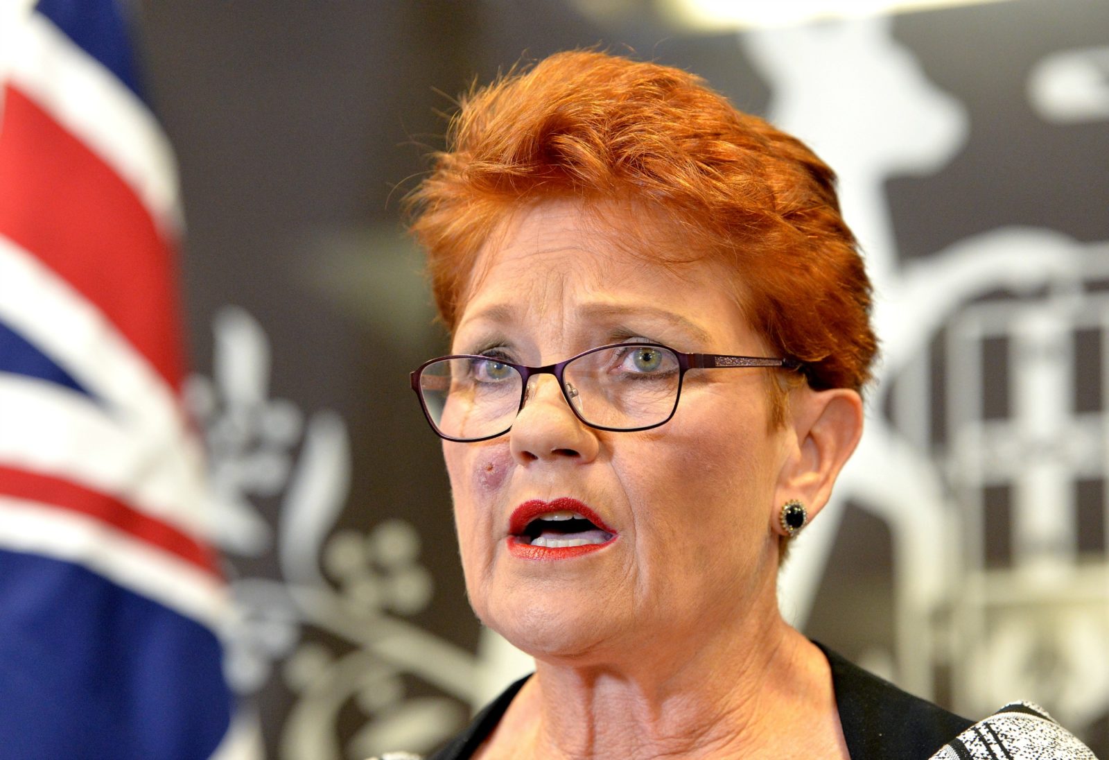 Pauline was bitten by a tick last week. Source: Getty.