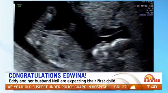 Edwina shared a photo of her baby scan on air. Source: Twitter/Sunrise.