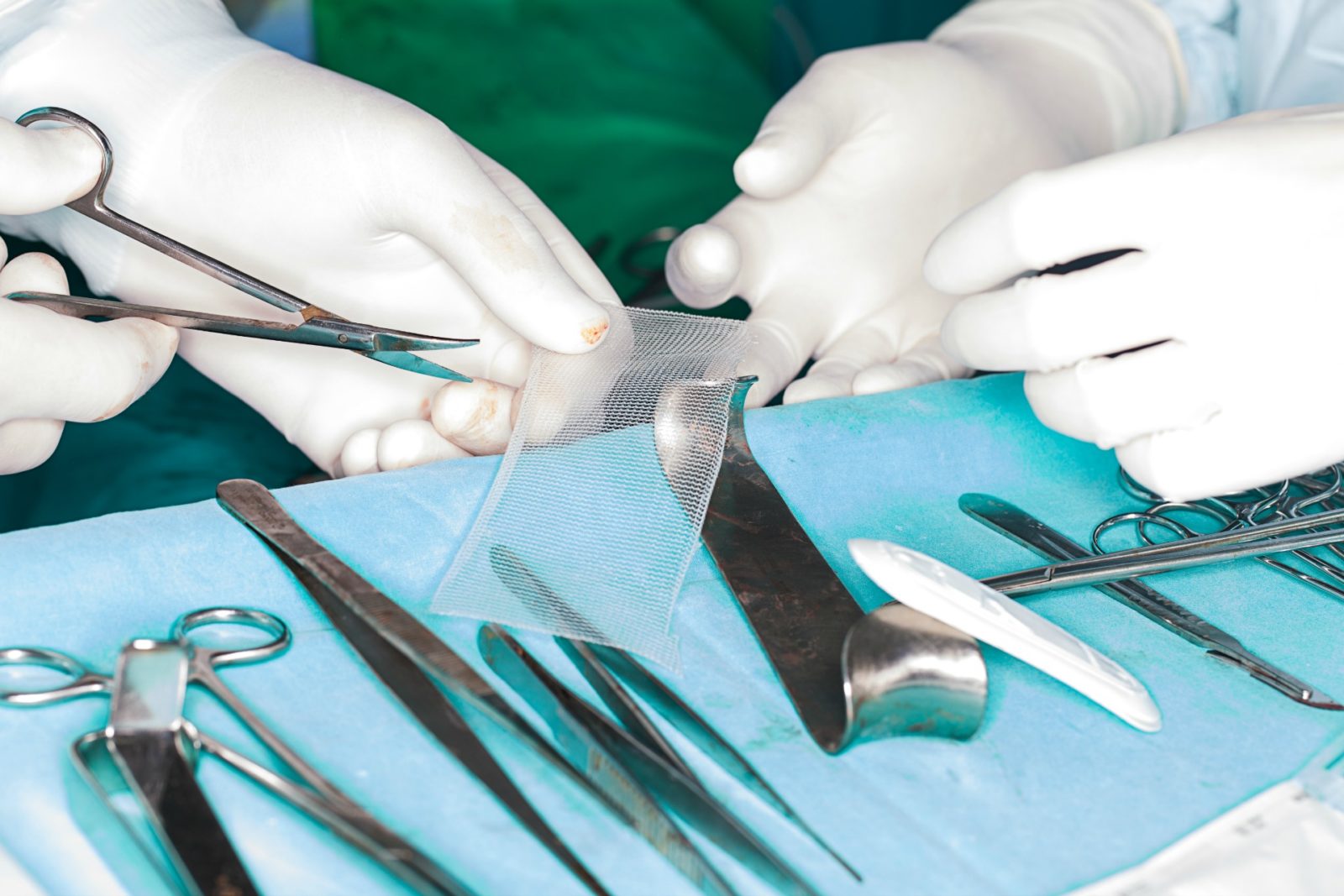 Surgeons using mesh in a bladder leakage operation.