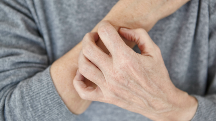 Our resident dermatologist details how to keep skin from getting dry. Source: Getty. 