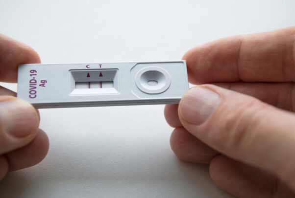 Rapid antigen detection test (RADT) with two red stripes showing a POSITIVE result of a human sample testing. Image: Getty