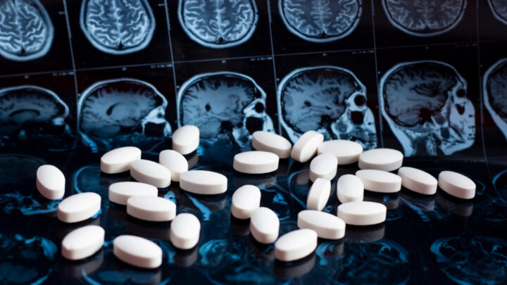 Although Lecanemab is not yet available in Australia and will require approval for use by the Therapeutic Goods Administration (TGA), Dementia Australia CEO Maree McCabe AM said its approval in the US was exciting news for those impacted by Alzheimer's disease across the globe. Source: Getty Images. 