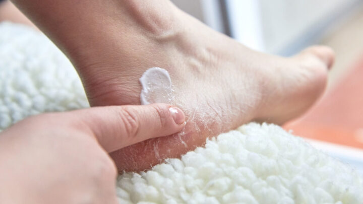 Tired of dealing with dry, cracked feet? Say goodbye to rough heels and hello to the soft, velvety feet you've been craving with these tried-and-true methods. Source: Getty Images. 